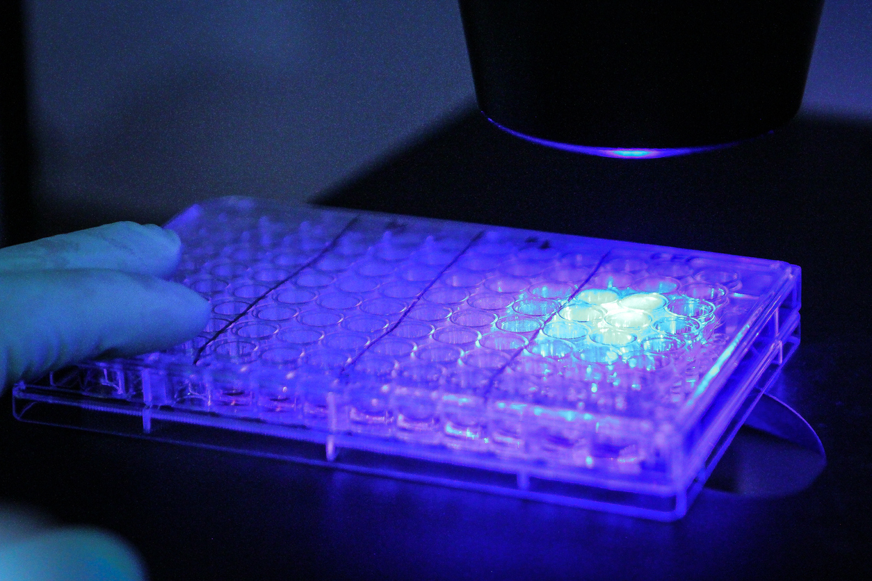 Interdisciplinarity Interview #3: Raman spectroscopy as a diagnostic tool – a stimulus for interdisciplinary collaboration
